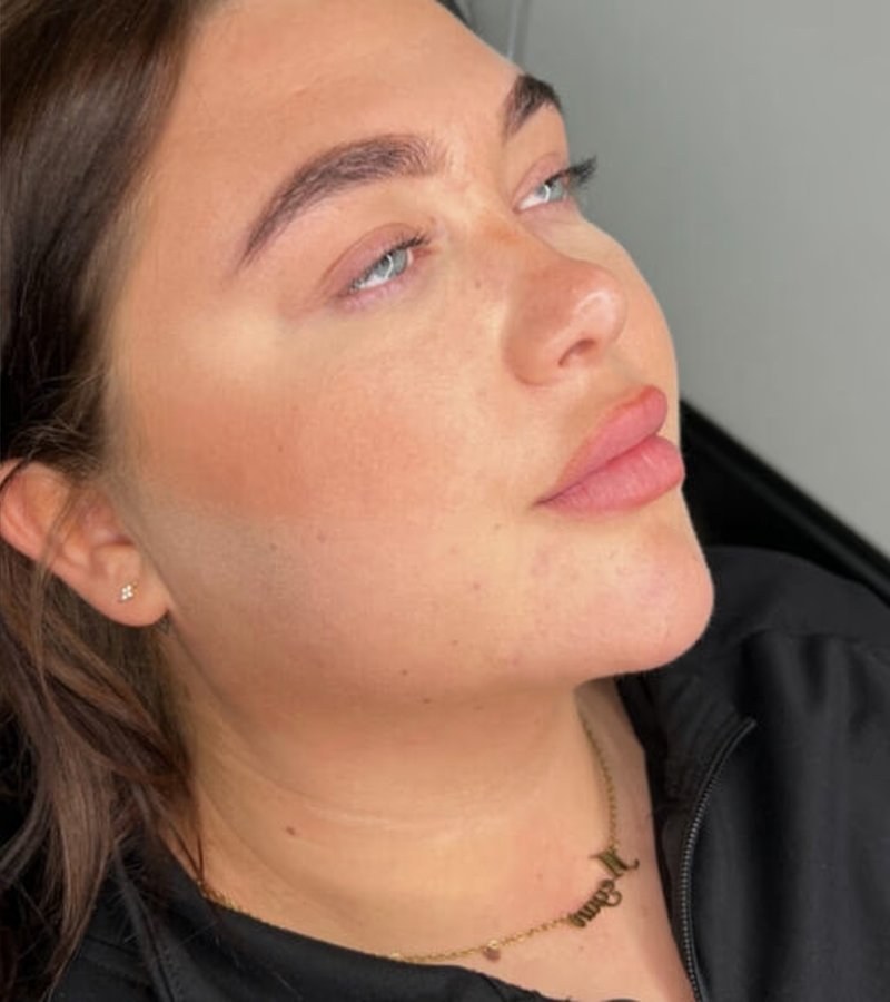 Defined facial contours